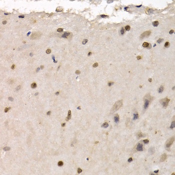 RAD1 Antibody