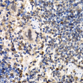 RAD1 Antibody