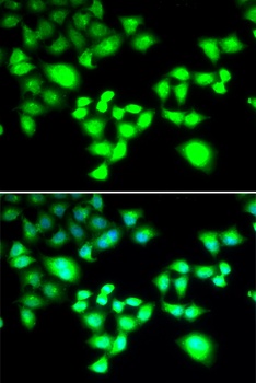 RAD1 Antibody