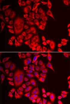 QPCT Antibody