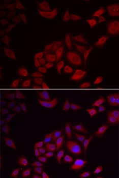 PIKFYVE Antibody