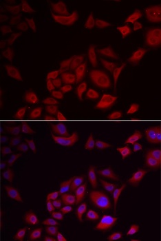 PIKFYVE Antibody