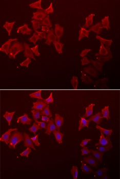 LECT1 Antibody