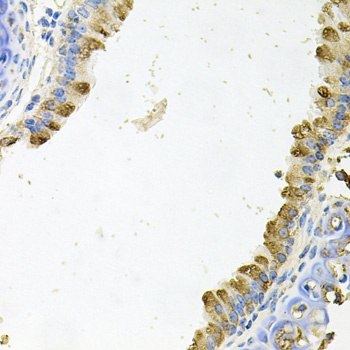 KLK11 Antibody