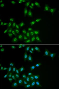 HPS1 Antibody