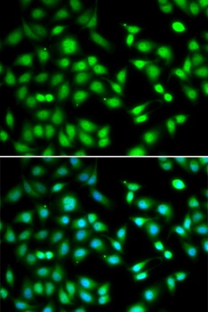 CDKN2D Antibody