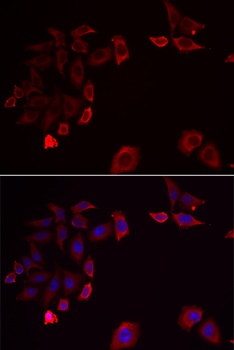 SKAP2 Antibody