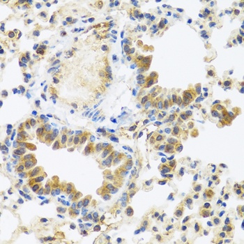 C8orf4 Antibody