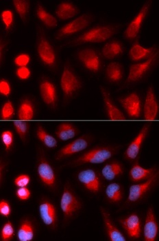 DCLRE1C Antibody