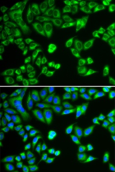 SH2B1 Antibody