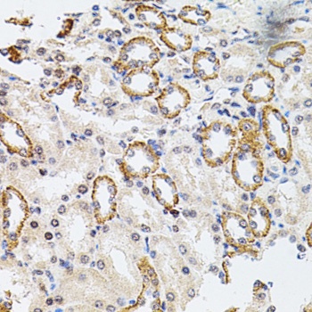 RPS6KA3 Antibody