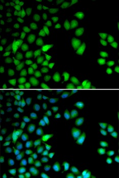 RPS6KA3 Antibody