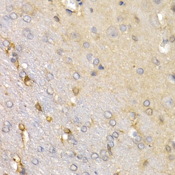 SFRP2 Antibody