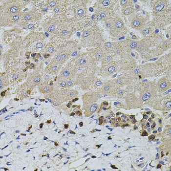 S100A12 Antibody