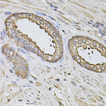 S100A12 Antibody
