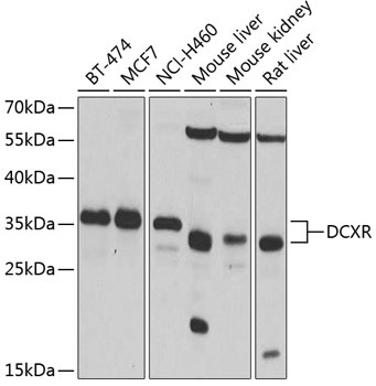 DCXR Antibody