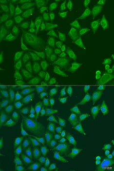 SUGCT Antibody