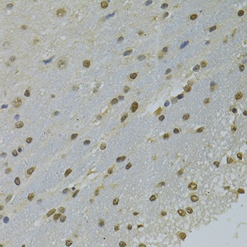 NLK Antibody