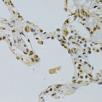 NLK Antibody