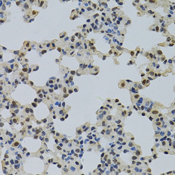 NLK Antibody