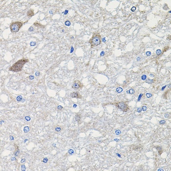 CDH23 Antibody