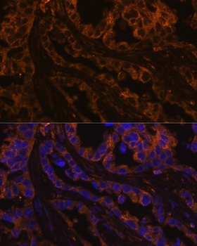 KRT7 Antibody