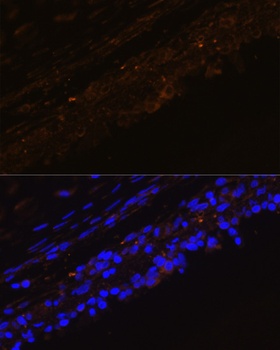 KRT7 Antibody