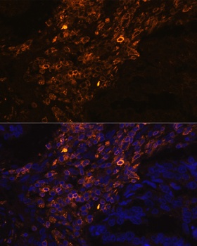 KRT7 Antibody