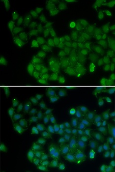 DNMT3L Antibody