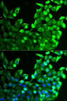 FGFR2 Antibody