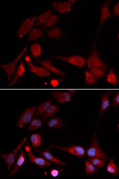 APBB1 Antibody