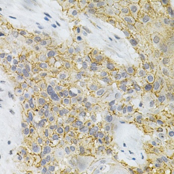 PPP2R4 Antibody