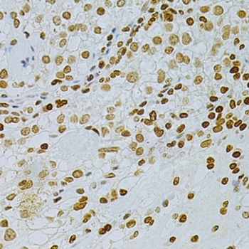 DKC1 Antibody