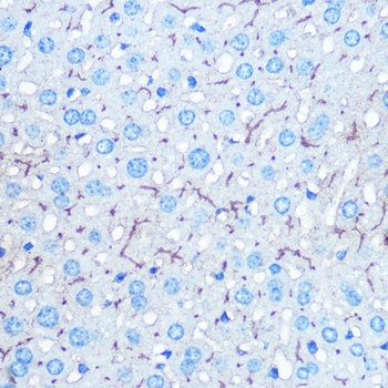 HILPDA Antibody