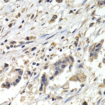 BUB1B Antibody