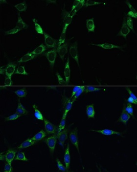 BUB1B Antibody