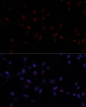 MKI67 Antibody