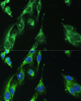 BLOC1S3 Antibody