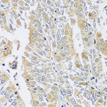 BLOC1S3 Antibody