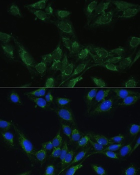 BLOC1S3 Antibody