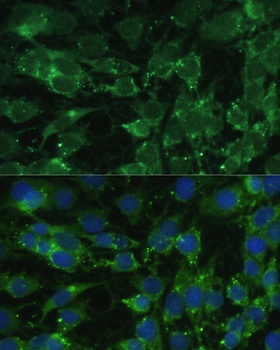 BLOC1S3 Antibody