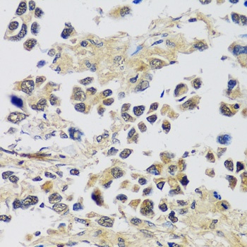 C12orf10 Antibody