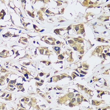 C12orf10 Antibody