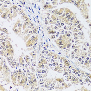 C12orf10 Antibody