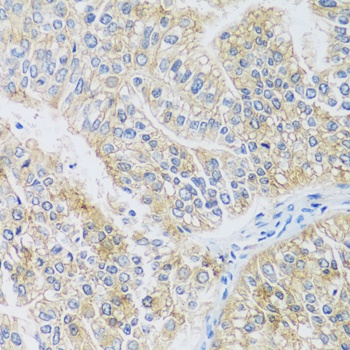 ARPC1A Antibody