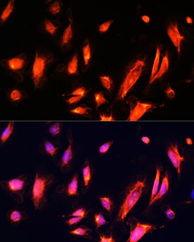 ARL4A Antibody