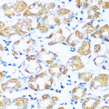 ARHGEF5 Antibody