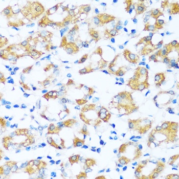 ARHGEF5 Antibody