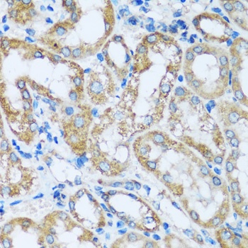 ARHGEF5 Antibody