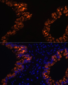 SCGB1A1 Antibody